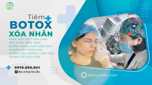 TIÊM BOTOX XÓA NHĂN