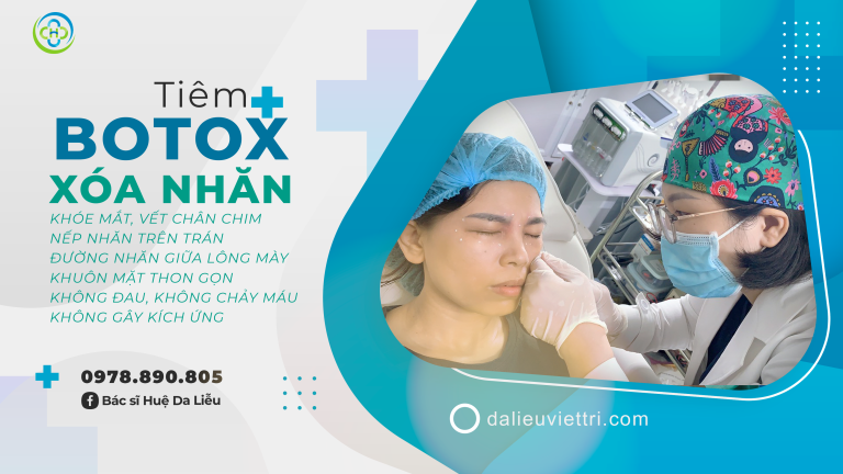 TIÊM BOTOX XÓA NHĂN